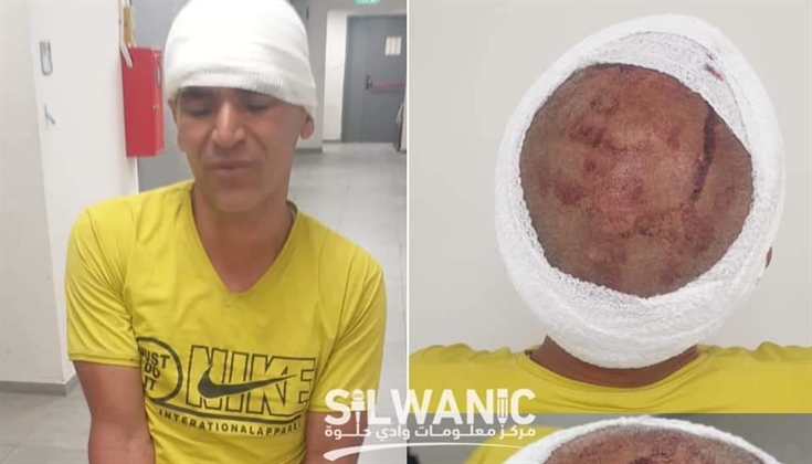 أعتقال الشاب المقدسي قاسم حربي الرجبي