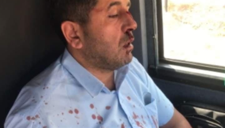 مستوطنون يعتدون على السائق المقدسي محمد القاق