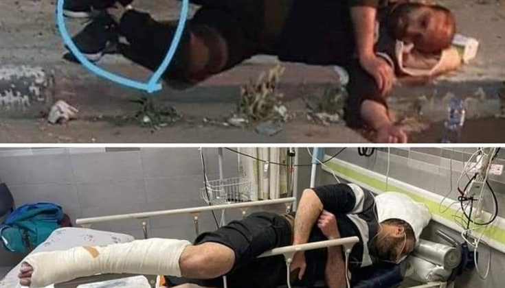 إصابة عدد من الشبان الفلسطينيين بكسور خلال محاولتهم اجتياز الجدار