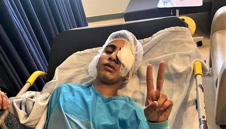 "محمد مطور".. فتى مقدسي أفقدته رصاصة إسرائيلية عينه