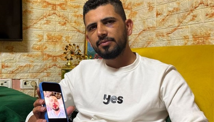 ضربوه حتى الإغماء.. سائق مقدسي ضحية اعتداء عنصري بتل أبيب