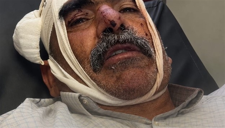 مأمون نصار من مادما يروي ساعات الاعتداء: «رشّوا الفلفل في فمي».
