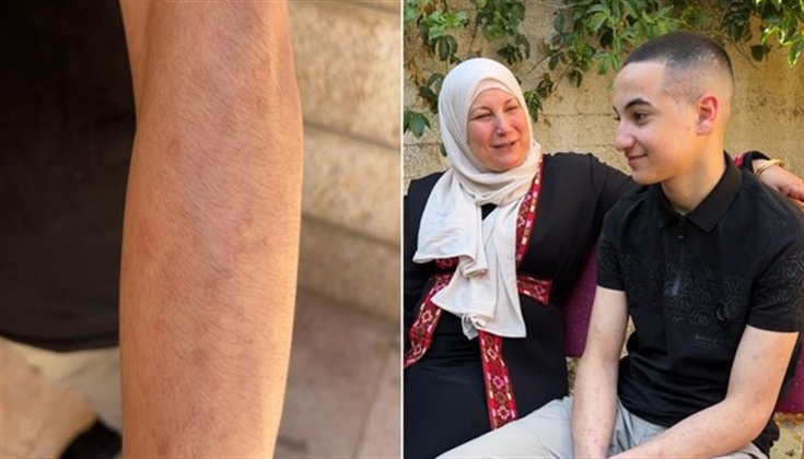 "السجن مليء بالأطفال".. فتى فلسطيني يروي تفاصيل اعتقاله 20 شهرا
