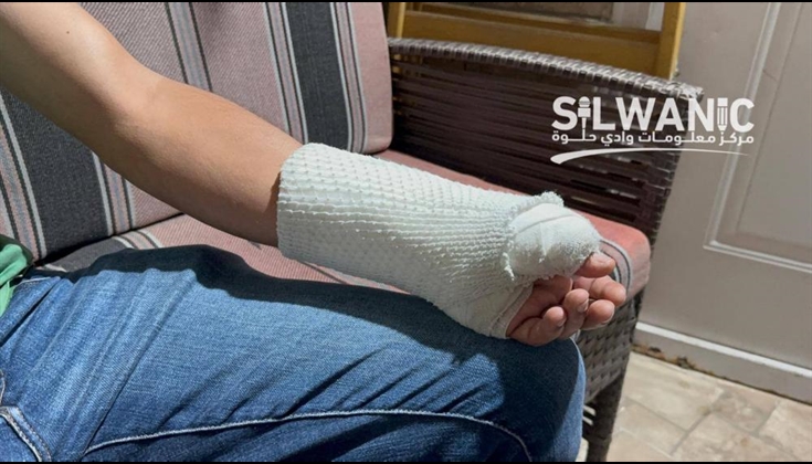 مقدسي يروي تفاصيل اعتداء مستوطنين عليه خلال عمله بالقدس